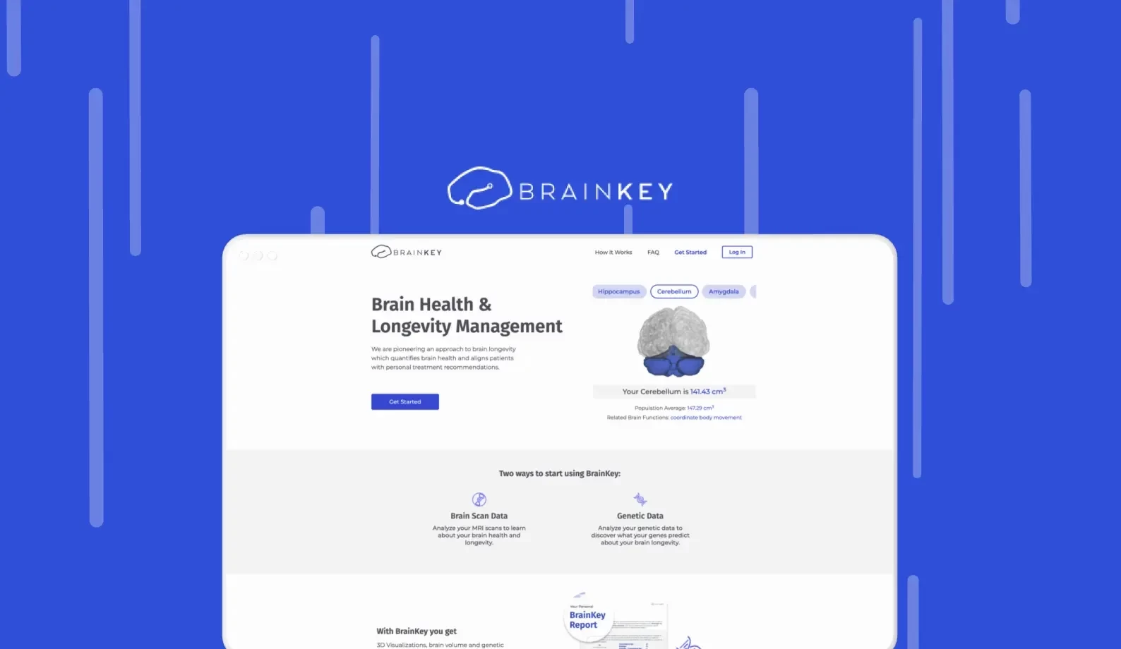 Brainkey-portfolio.webp